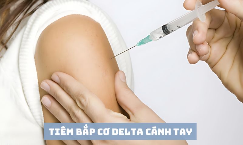 Vị trí tiêm bắp cơ delta cánh tay 