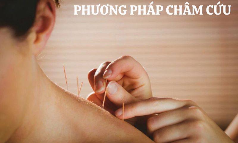 tìm hiểu phương pháp chữa bệnh theo Y học Cổ truyền
