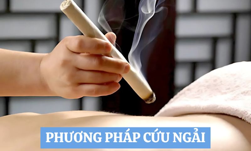 phương pháp chữa bệnh theo Y học Cổ truyền cứu ngải 