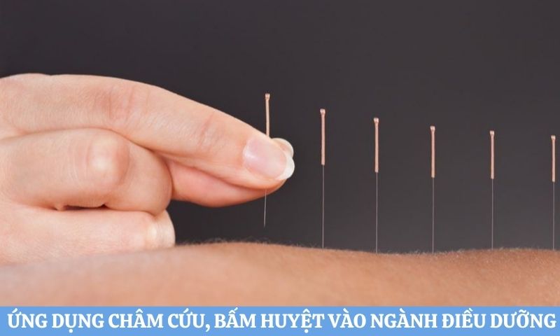 Ứng dụng Y học cổ truyền vào ngành Điều dưỡng - Châm cứu, bấm huyệt