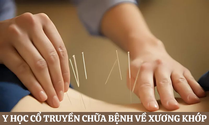 tìm hiểu Y học Cổ truyền chữa bệnh gì