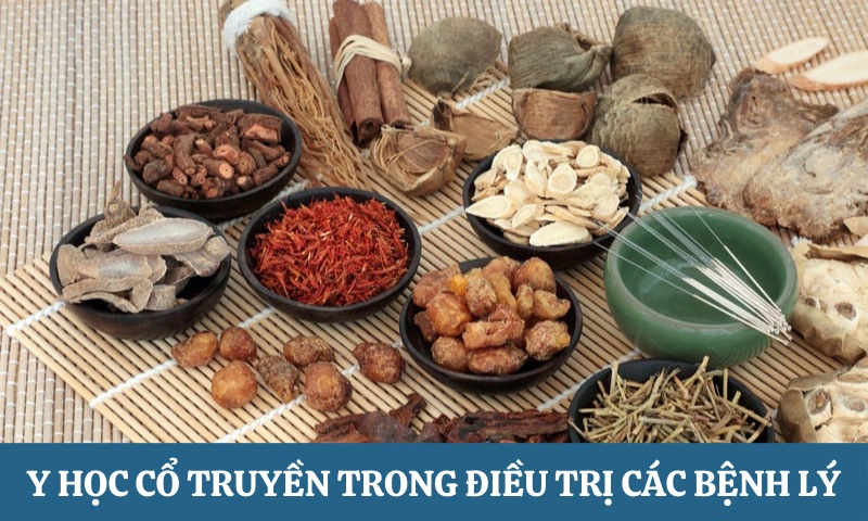 Ưu điểm của Y học Cổ truyền hỗ trợ điều trị các loại bệnh lý
