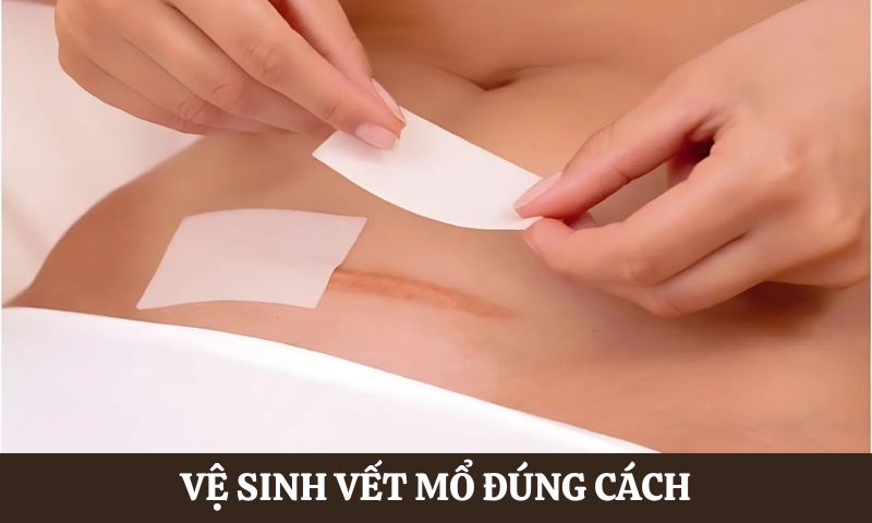 Chăm sóc người bệnh sau phẫu thuật tại nhà 