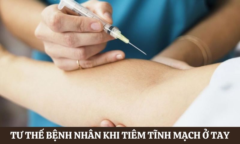 Tư thế bệnh nhân khi tiêm tĩnh mạch ở cánh tay, mu bàn tay